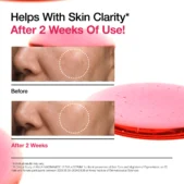 10%+TXA 4% Serum_4