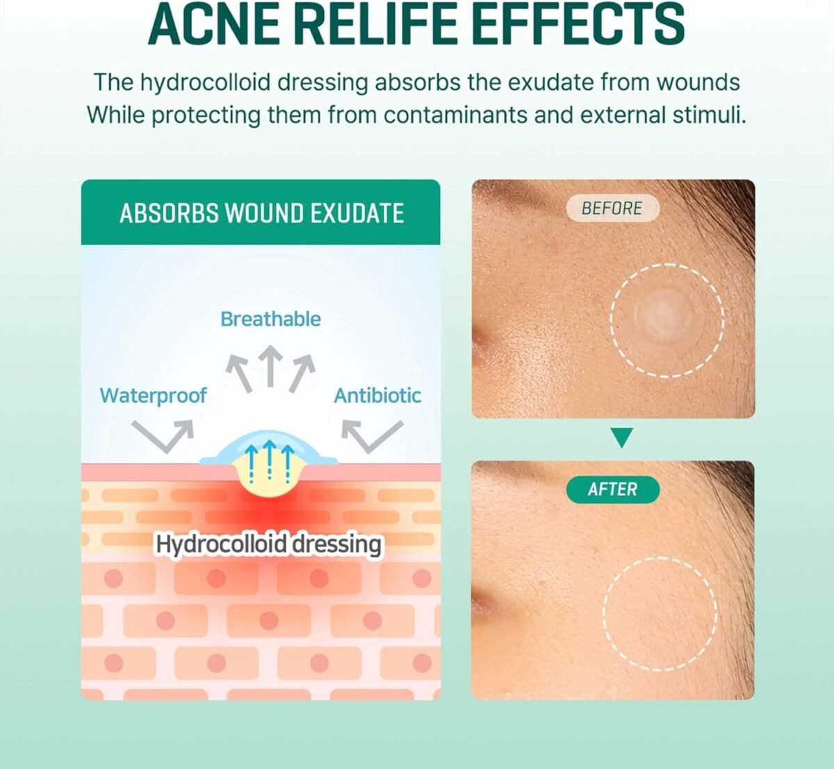 SOME BY MI Clear Spot Patch_3 SOME BY MI Clear Spot Patch_3