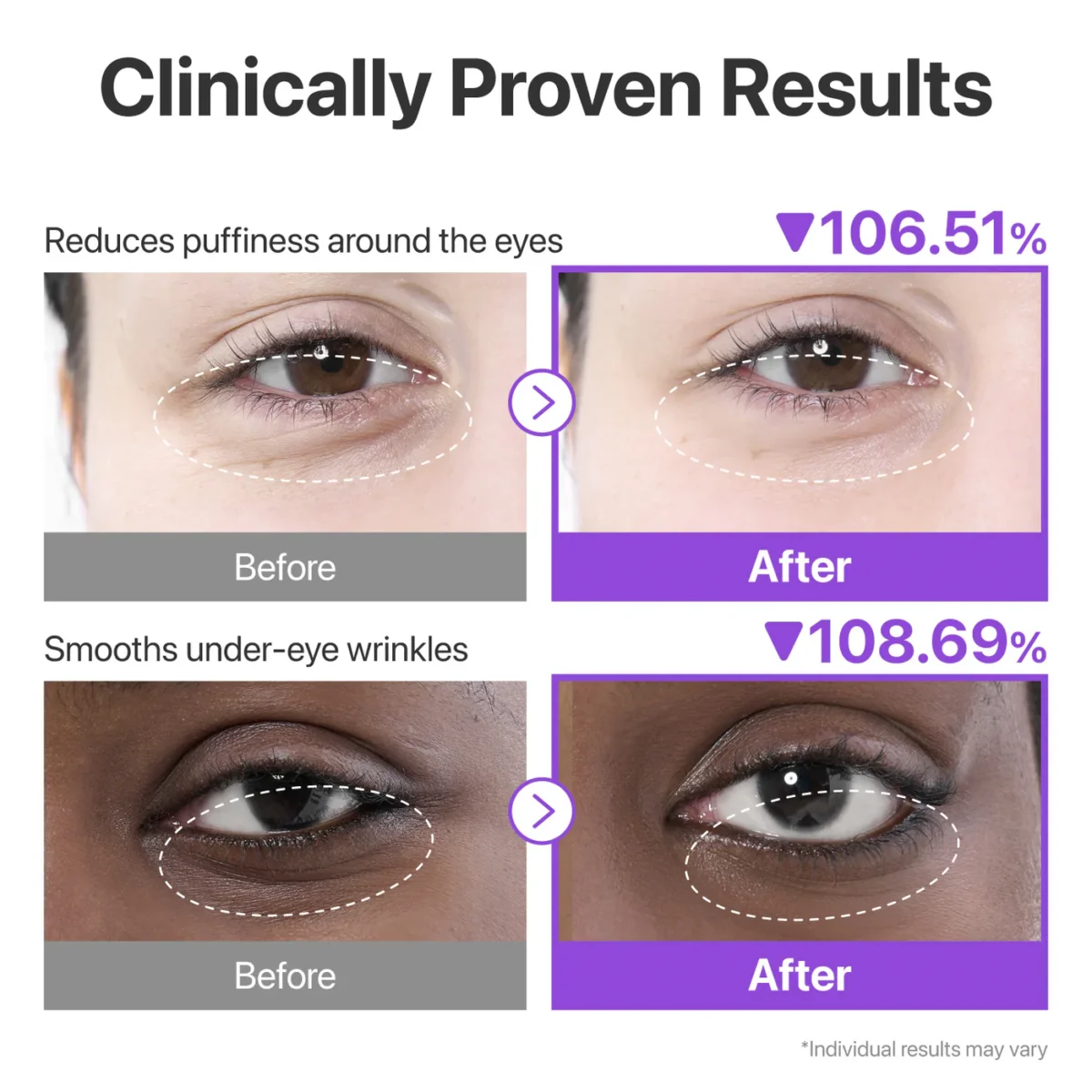 Numbuzin - No.9 NAD+ Eye Patches_3 Numbuzin - No.9 NAD+ Eye Patches_3