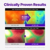 Centellian24 - Expert Madeca Cream Active Renew PDRN_6