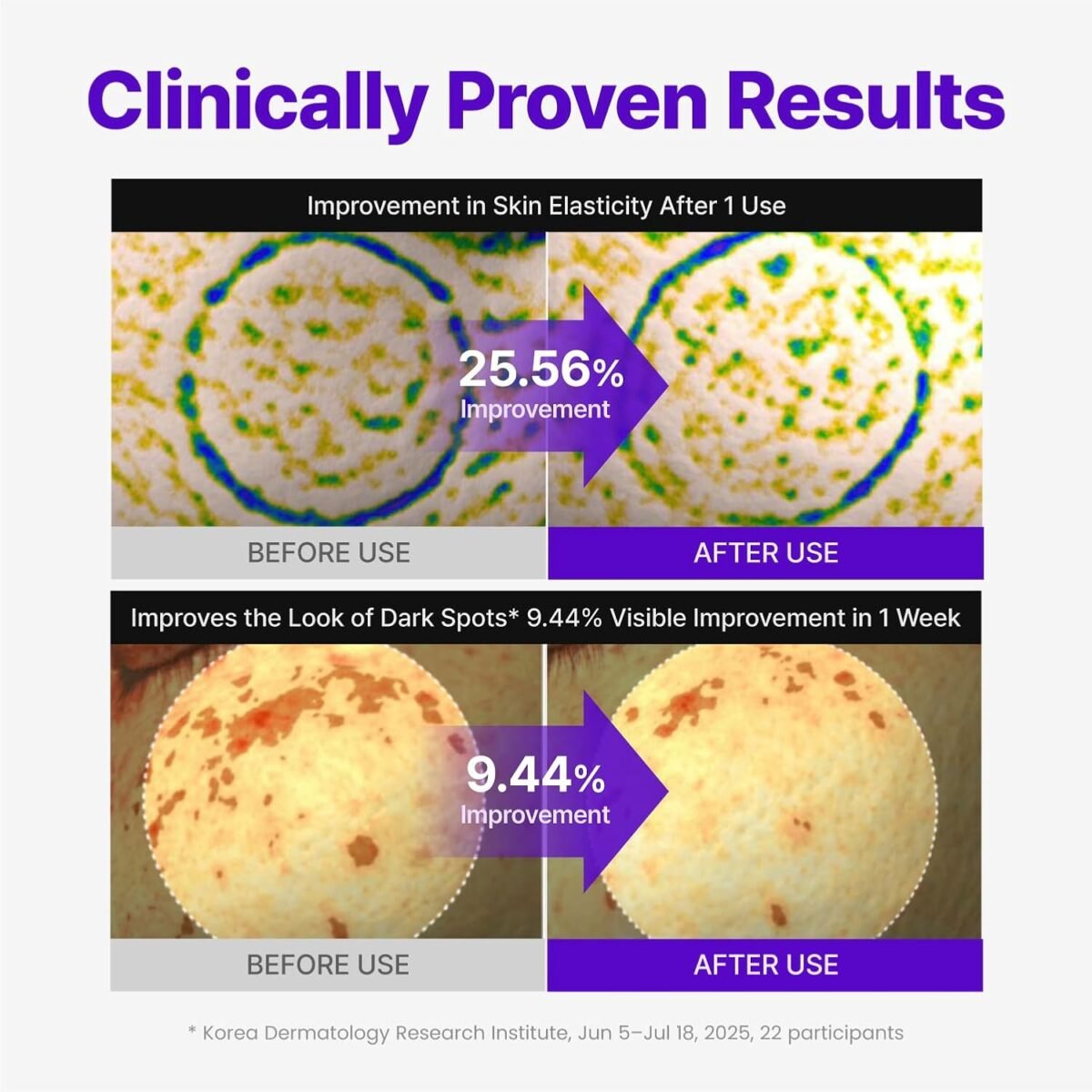 Centellian24 - Expert Madeca Cream Active Renew PDRN_7 Centellian24 - Expert Madeca Cream Active Renew PDRN_7