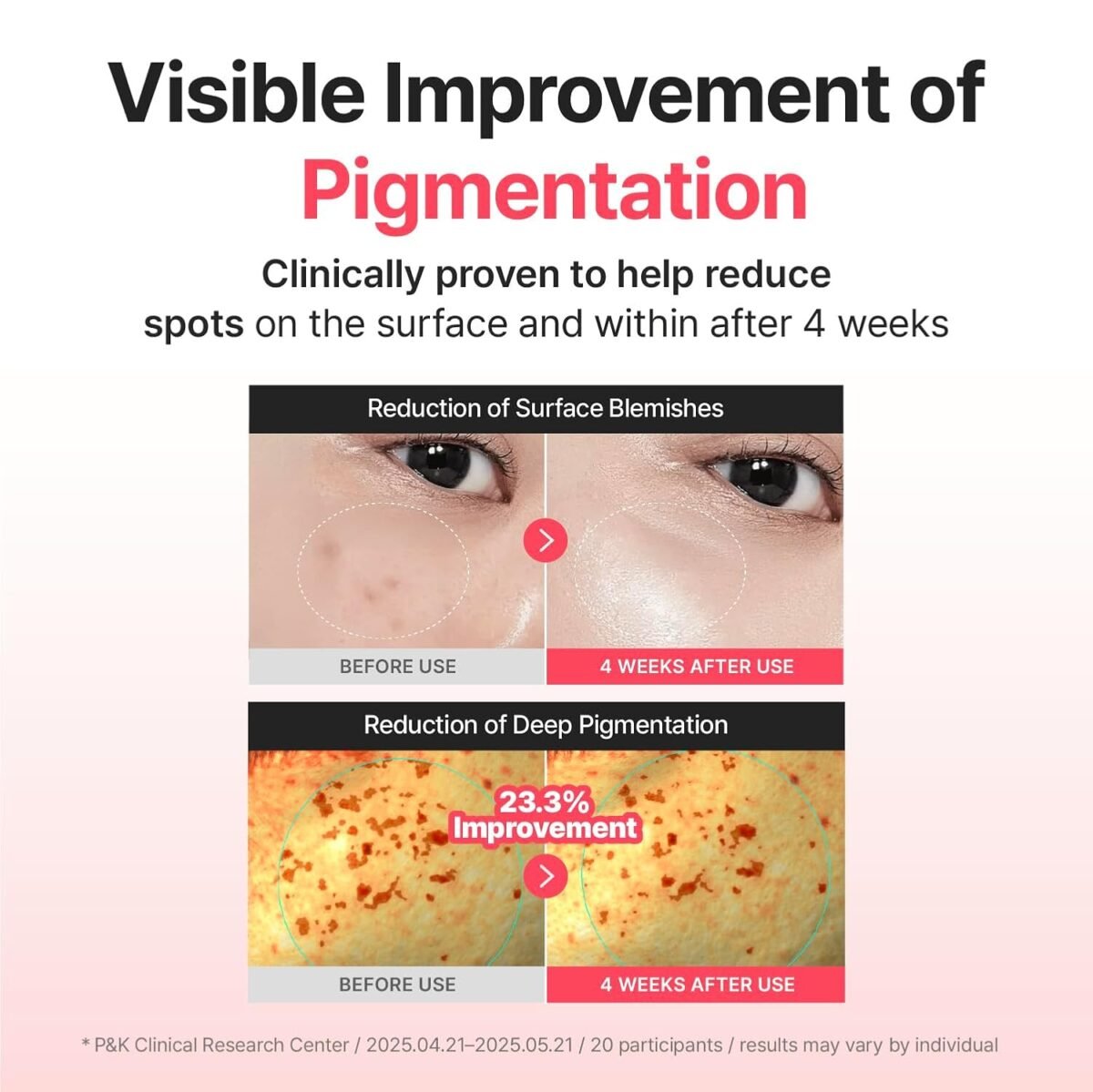 Centellian24 Madeca Mela Capture Ampoule Capsule Cream_4 Centellian24 Madeca Mela Capture Ampoule Capsule Cream_4