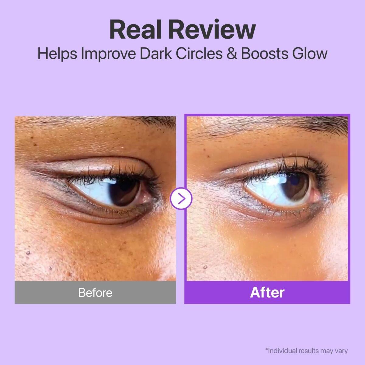 numbuzin No.9 NAD+ Retinol Eye Cream_4 numbuzin No.9 NAD+ Retinol Eye Cream_4