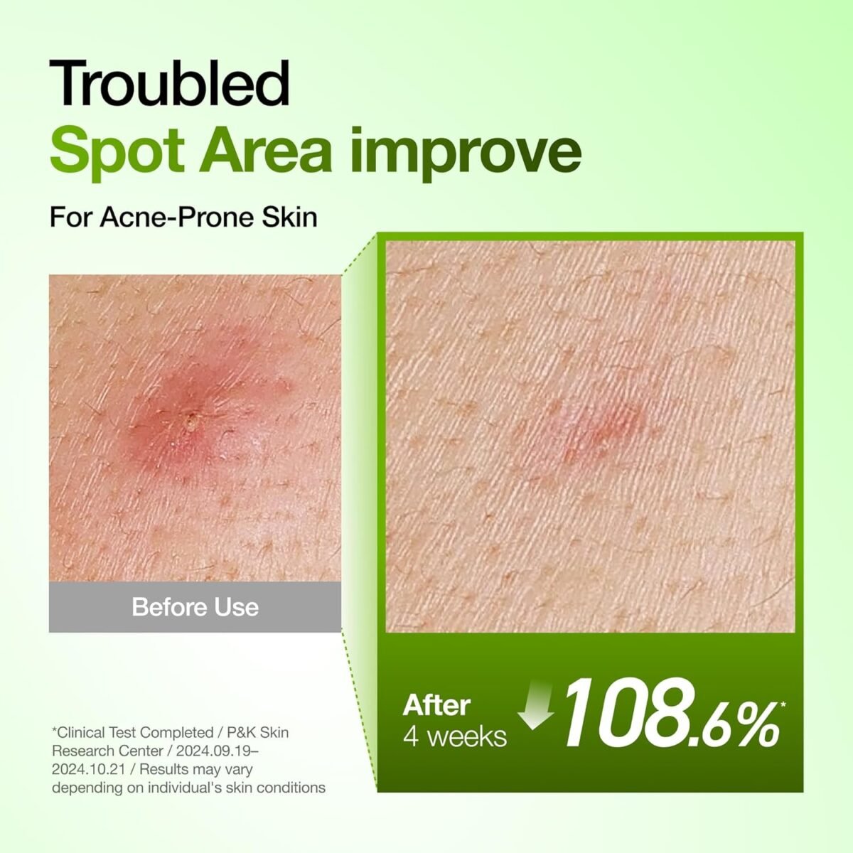 Anua_Azelaic Acid 10% Hyaluron Redness Soothing Serum_5 Anua_Sérum apaisant contre les rougeurs à l'acide azélaïque 10 % et à l'acide hyaluronique_5