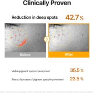 Celimax Pore + Dark Spot Brightening Serum_4