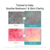 MEDICUBE Azelaïnezuur en Niacinamide Dieptereinigende Schuimreiniger_3