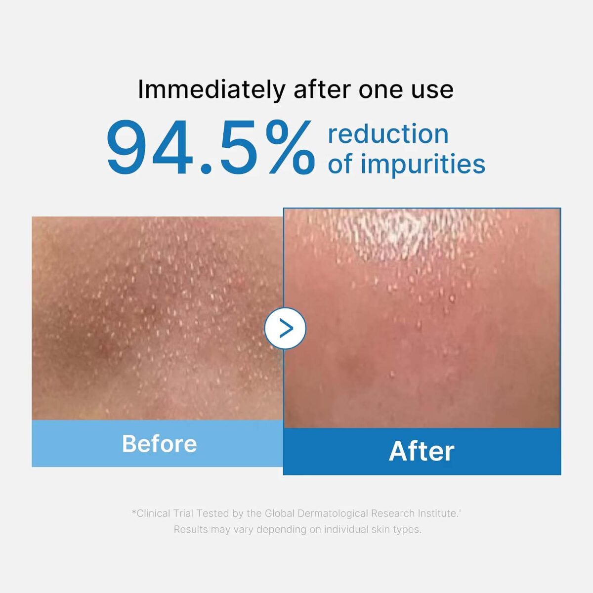 MEDICUBE Zero Pore Blackhead Deep Cleansing Oil_3 MEDICUBE Zero Pore Diepreinigende Olie tegen mee-eters_3