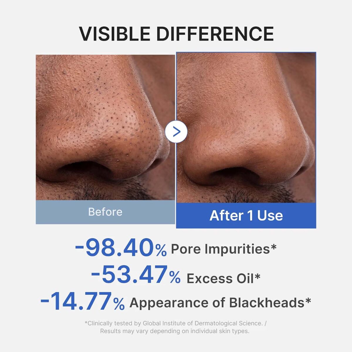 MEDICUBE Zero Pore Blackhead Mud Mask_4 MEDICUBE Zero Pore-moddermasker tegen mee-eters_4