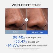 MEDICUBE Zero Pore-moddermasker tegen mee-eters_4